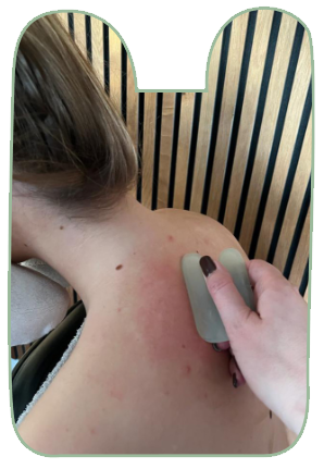 guasha-behandeling-1-sd-guasha